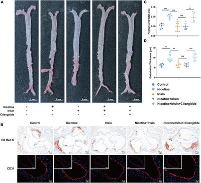 Irisin Suppresses Nicotine-Mediated Atherosclerosis by Attenuating Endothelial Cell Migration, Proliferation, Cell Cycle Arrest, and Cell Senescence